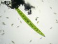 Closterium acerosum